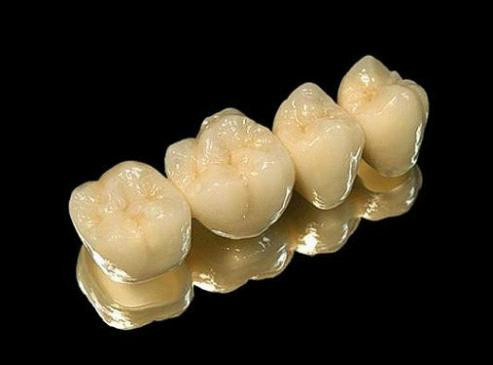 假牙最便宜一颗多少钱,假牙最贵