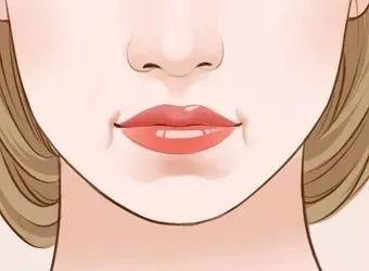 木偶纹下垂怎么提升,20岁木偶纹怎么消除