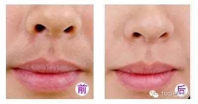 必备脱毛色神器,适用于胡子,眉毛,腋窝,汗毛