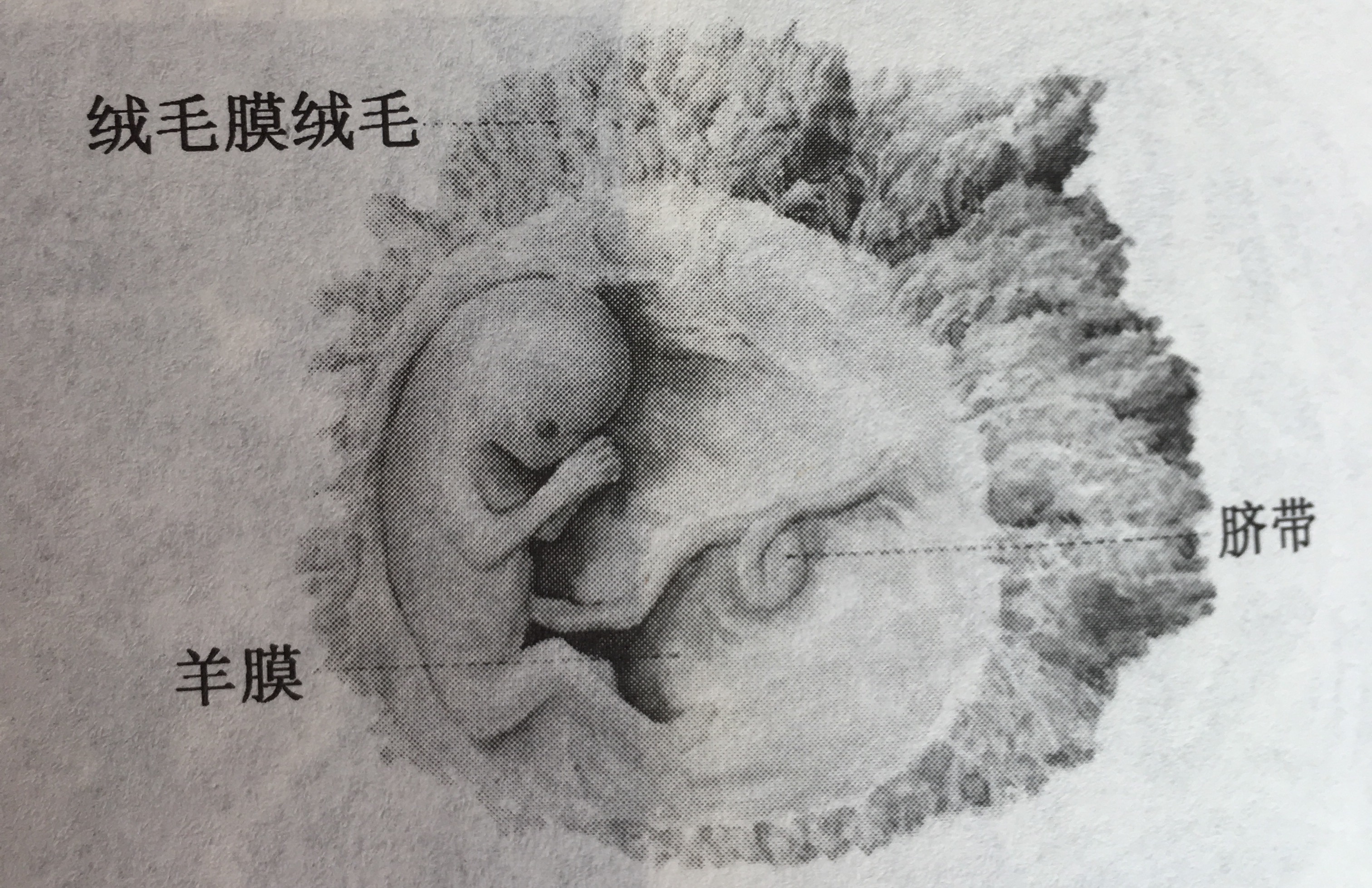 双胞胎胎儿发育过程动画视频,怀孕期间胎儿发育过程的视频