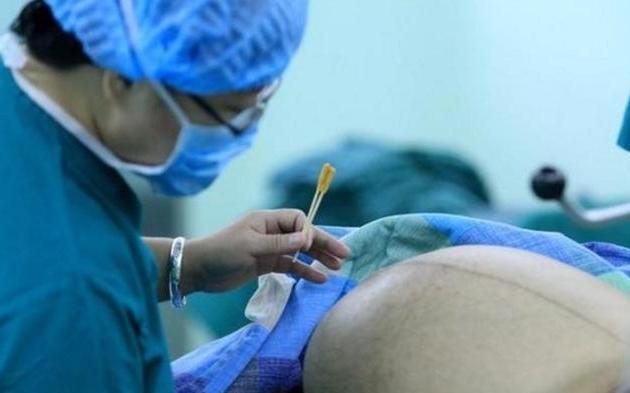 为什么生孩子前要检查身体,生孩子前为什么需要处理毛发