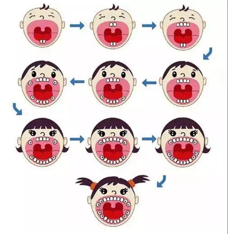 儿童乳牙更换年龄和顺序,宝宝乳牙萌出顺序