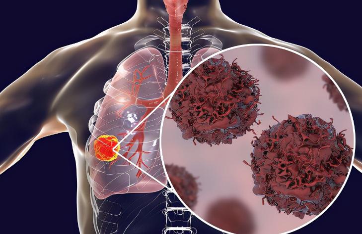 清洗肠道用哪些药,清洗肠道六种食物