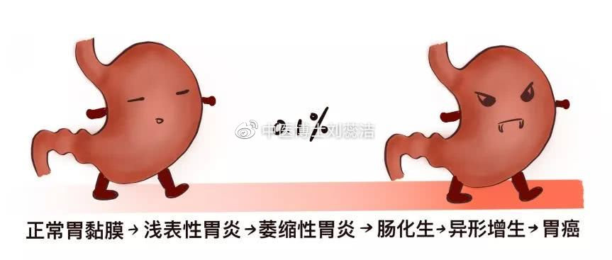 萎缩性胃炎可逆转吗吃什么药,慢性萎缩性胃炎c3可以逆转吗