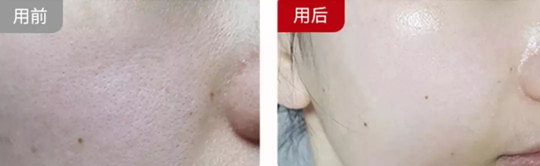 李湘代言美容仪,李湘护肤视频