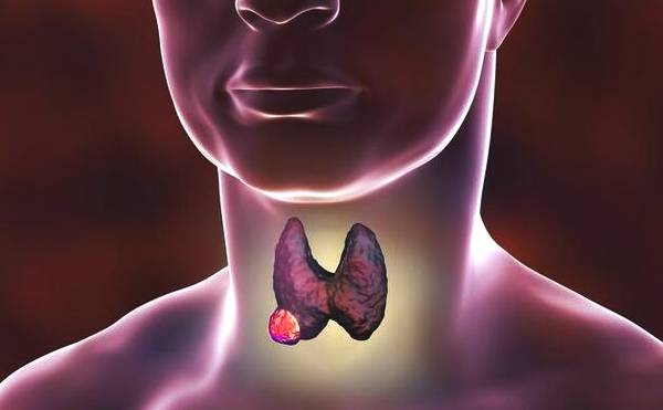 同位素治疗甲亢有何副作用,甲亢用药甲巯咪唑片副作用