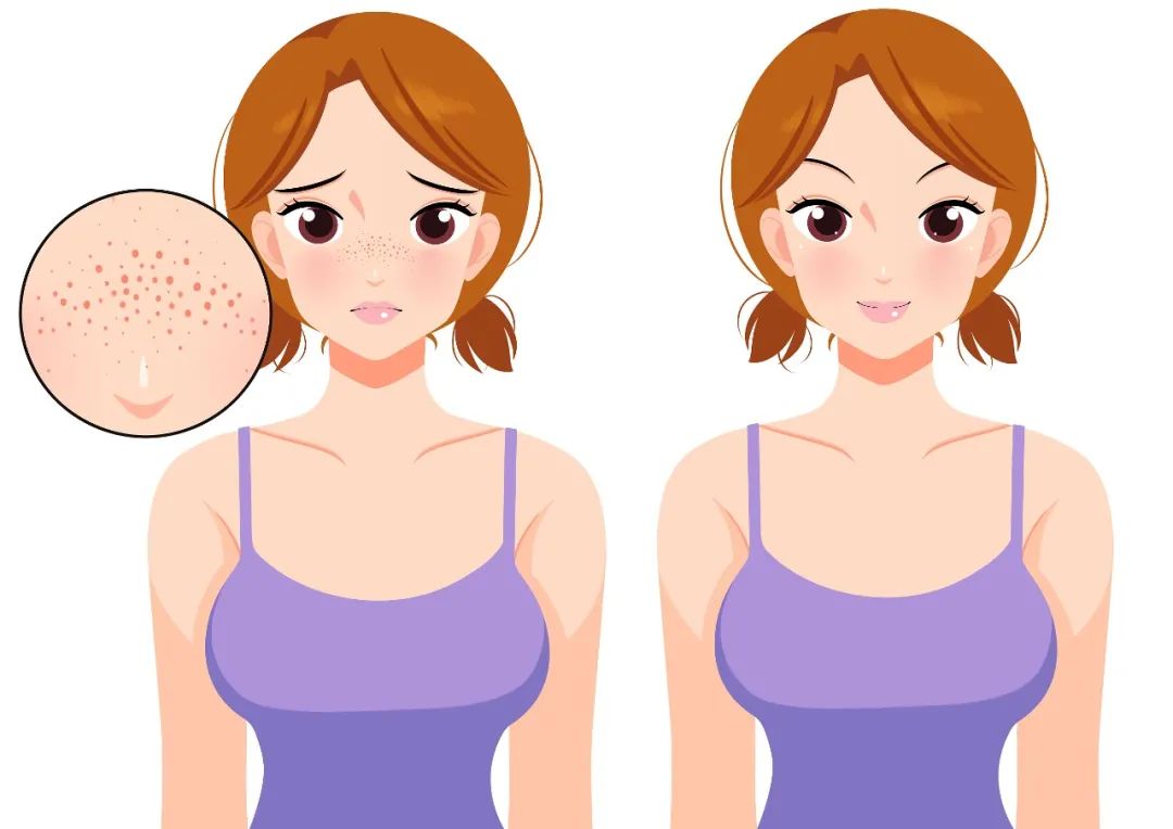 不同肌肤选择什么样子的洁面,如何选择一款合适的洁面产品