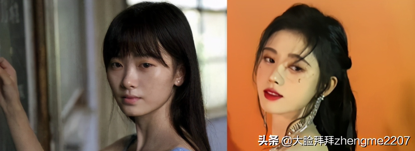 颧骨颧弓内推手术全过程真人,颧骨内推颧弓手术恢复全过程分享