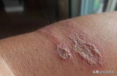 @云浮人虫出没，请注意！