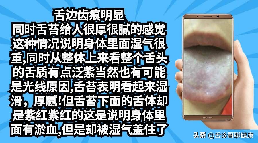 舌诊歌舌象分析及感悟,舌诊哥肝郁脾虚