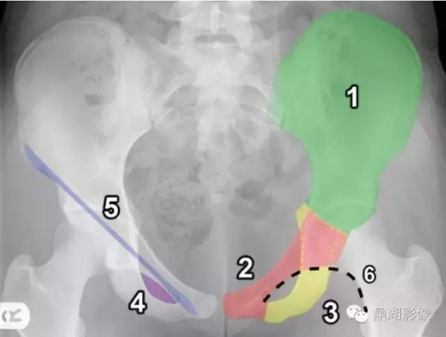 X线高清图谱|精致腹部解剖
