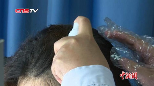 为什么英国人头越来越秃,英国谢顶