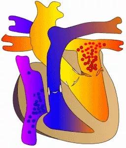 什么情况下做胎儿心脏超声检查,胎儿心脏超声检查有必要吗