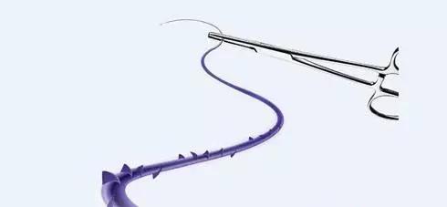 张宗学博士线雕案例分析,张宗学线雕案例