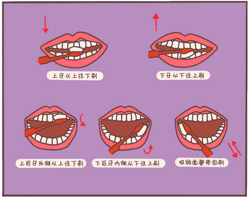 你的牙是怎样一步步坏掉的,牙齿是怎么变成蛀牙的