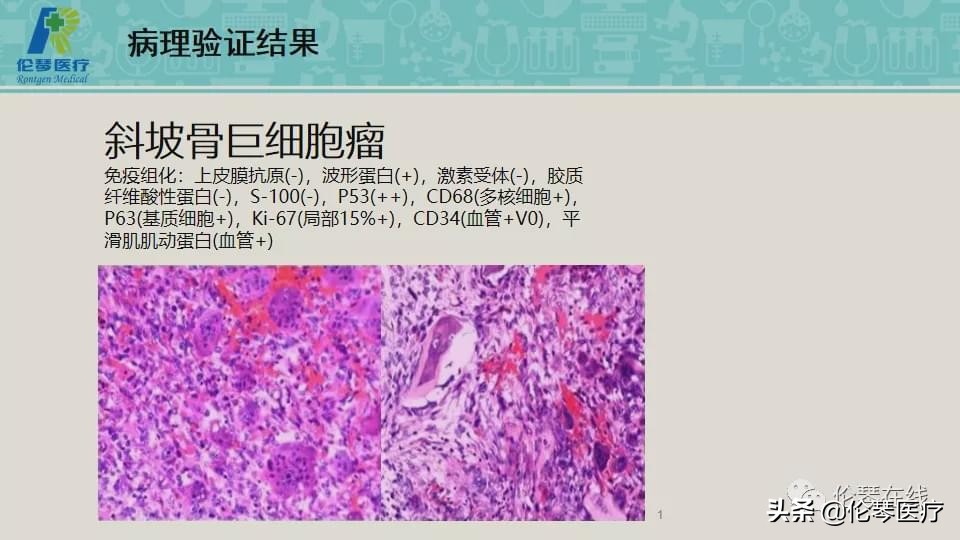 上海教授詹松华,上海曙光医院詹松华简介