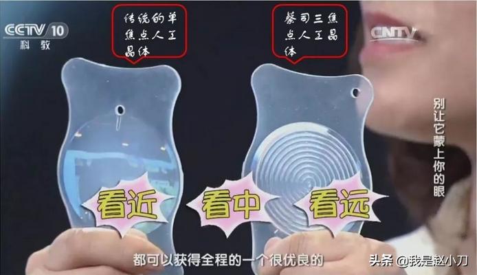 高度近视患者出现白内障的症状,高度近视轻微白内障怎么办