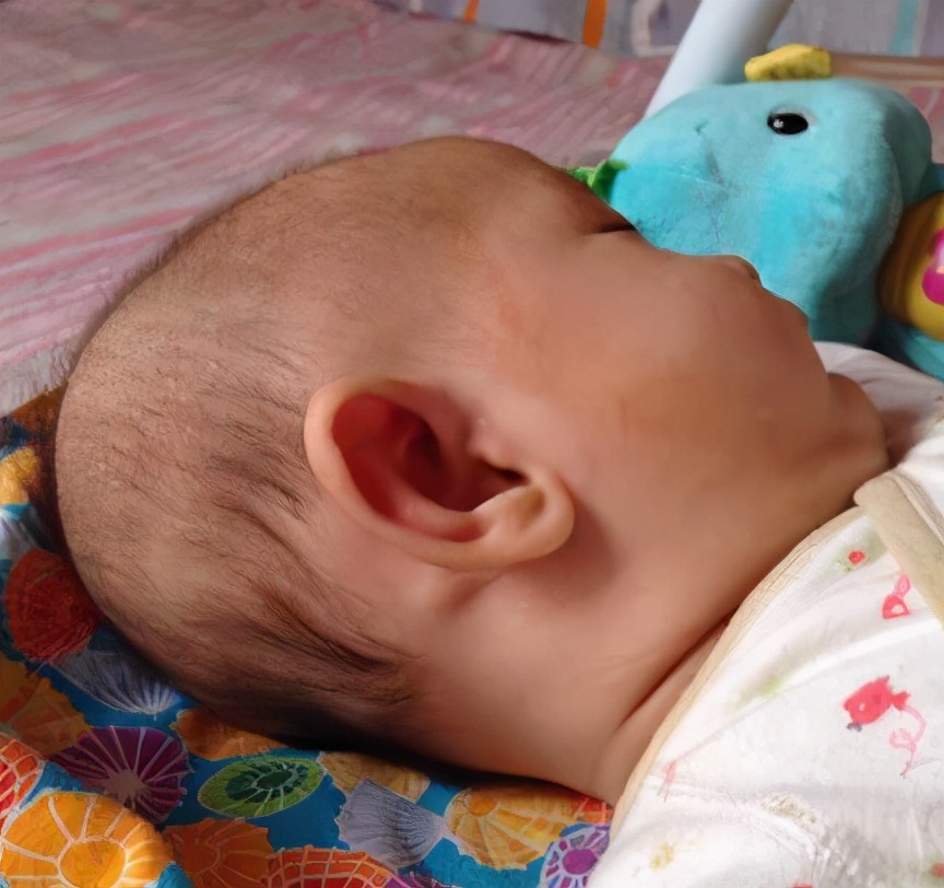 宝宝脖子多处有淋巴结怎么办,宝宝脖子上有淋巴结怎么治疗