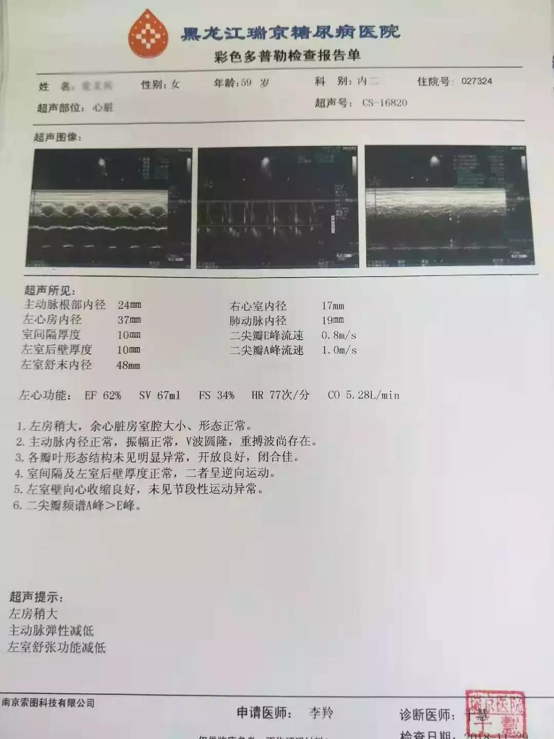 肥胖引起二型糖尿病用吃药吗,糖尿病联合用药方案