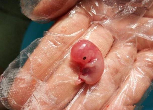 流产后胎儿完整模样,60天流产出来的婴儿感觉到痛吗