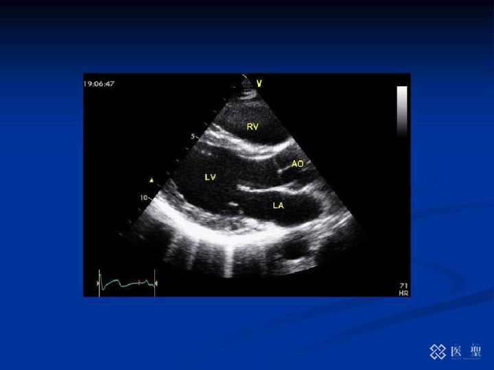 iseihealth:为什么即使在绝经后，每年的检查也是必要的