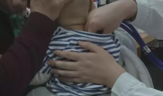 小孩湿疹反反复复怎么根除,儿童湿疹反反复复如何彻底根除