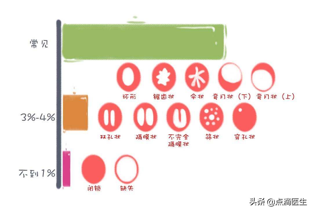 女性常见的4种谣言,妇科的传言有哪些