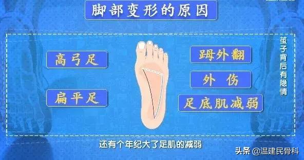 健康之路茧子,cctv10健康之路在线直播回看