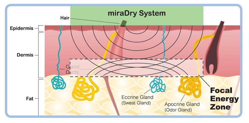 最让多汗人士尴尬的问题,一篇全解决
