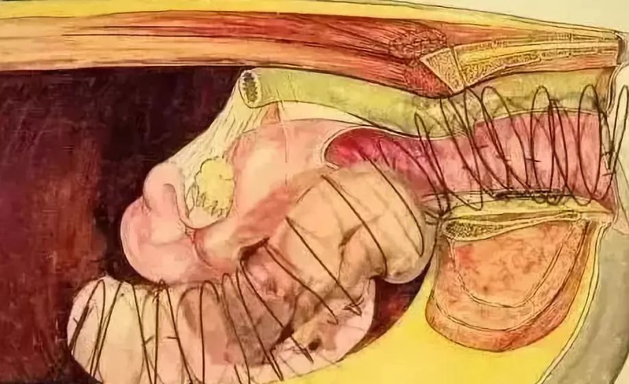 母猪难产掏小猪示范教程,怎样掏难产的母猪