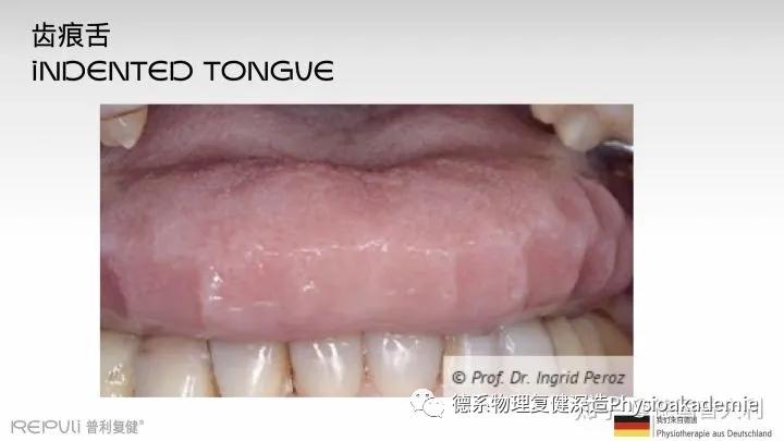 颞下颌关节紊乱综合征,颞下颌关节紊乱主要检查什么项目