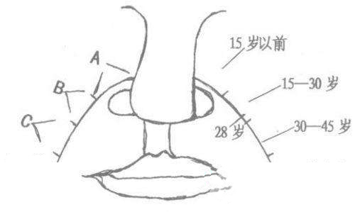 怎么能淡化法令纹的小妙招,法令纹显老不用愁一招改善法令纹
