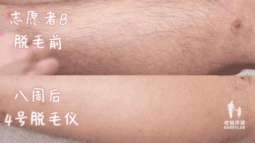 最真实的脱毛仪,bequeen脱毛仪实测