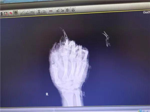 医院疫情防控日常救治,医院疫情医疗救治措施