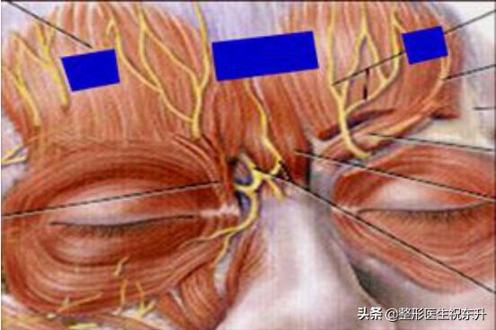 额部除皱术的目的是什么,什么是额部除皱术