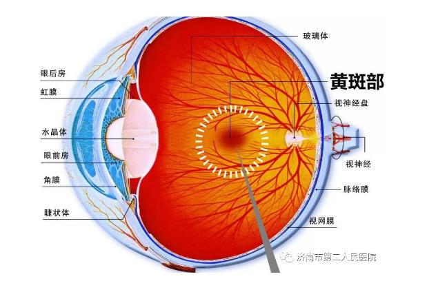 「日照健康」45岁以上中老年人群要警惕这种眼病,不及时治疗视力将迅速下降