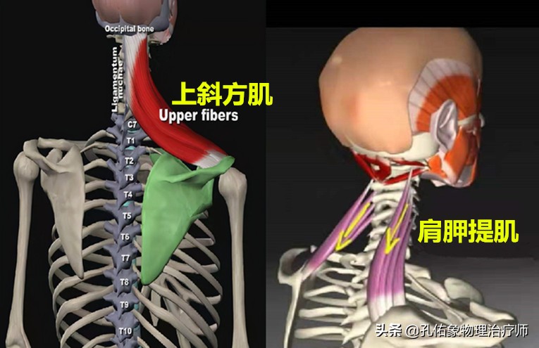 左肩膀和肩胛骨内侧肌肉会疼,右肩膀肩胛骨疼痛怎么快速缓解