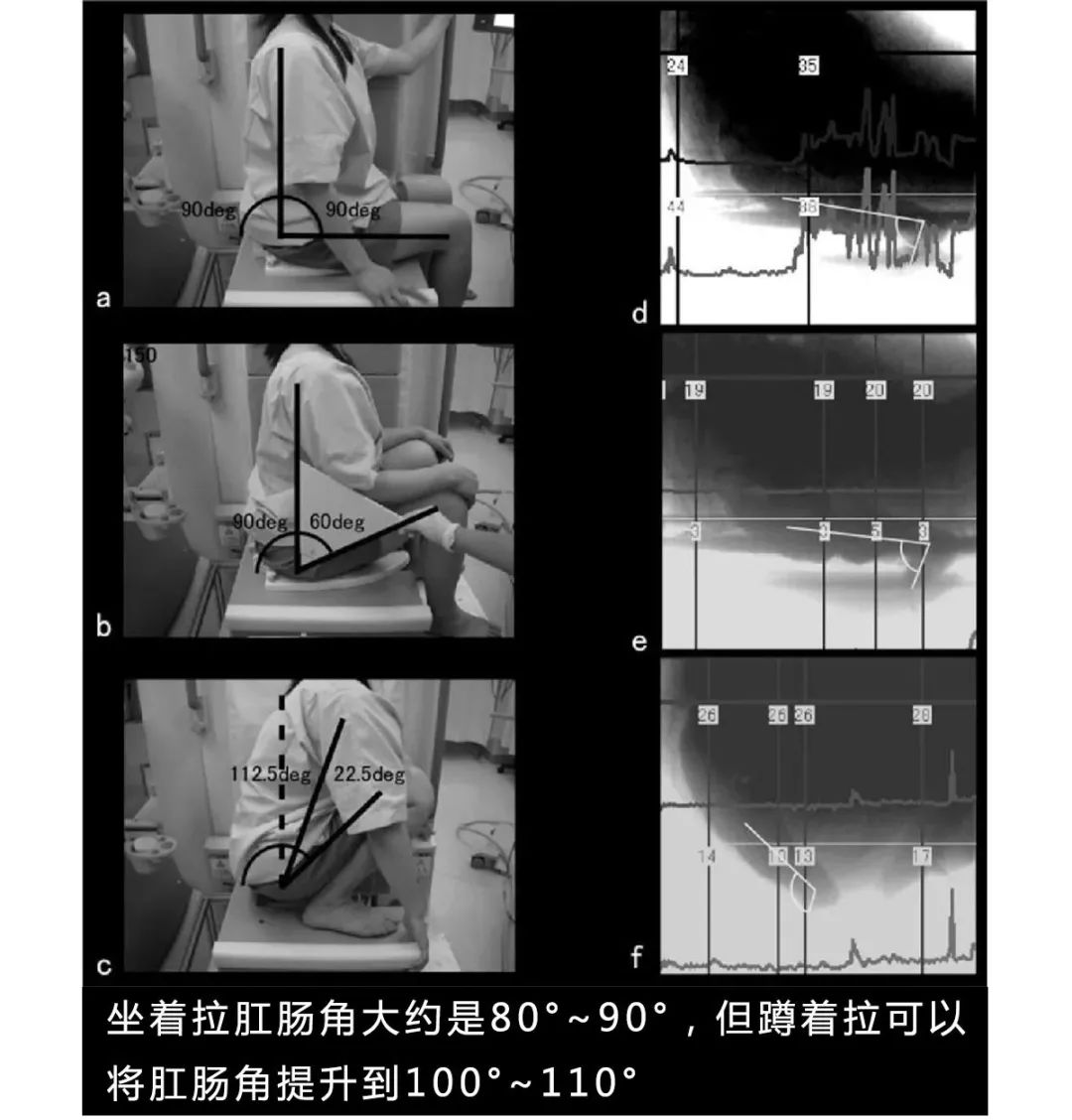 上厕所用什么姿势最好？