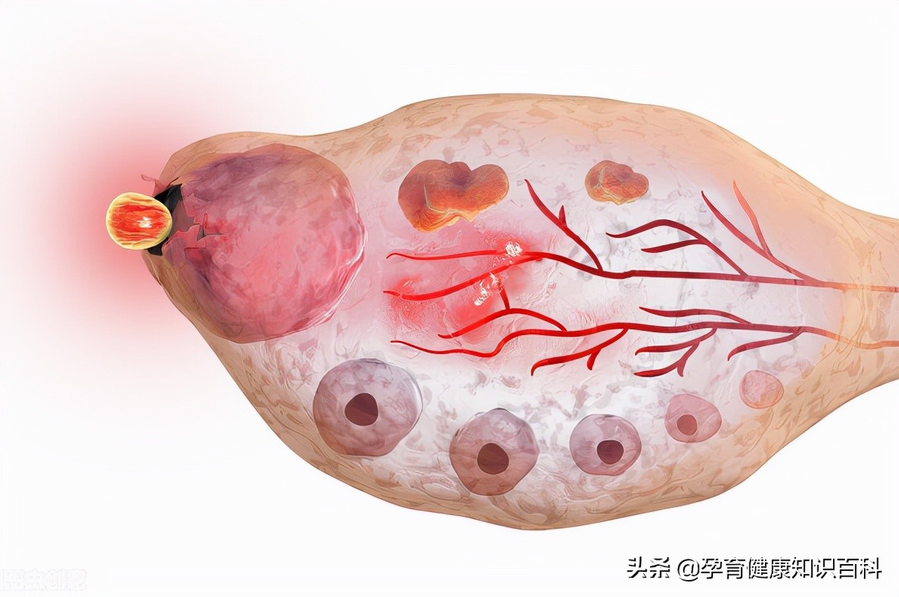卵泡不知道排了还是没有排,卵泡也正常怎么就怀不上孕呢