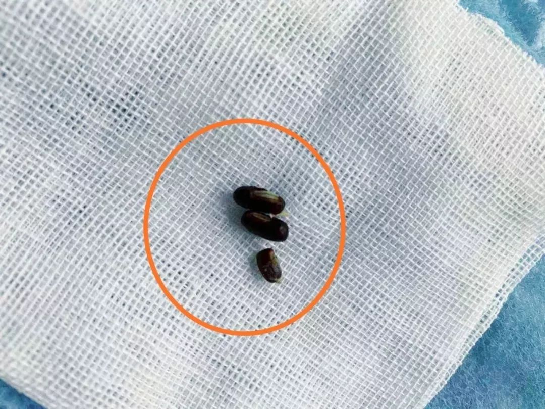 七岁小孩耳朵前面长小米粒,7岁小孩耳朵里有虫