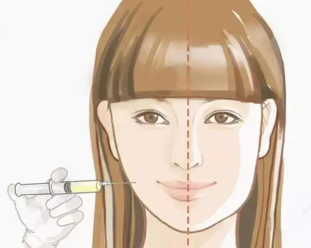 瘦脸针要去什么医院打,想打瘦脸针有什么比较出名的医院