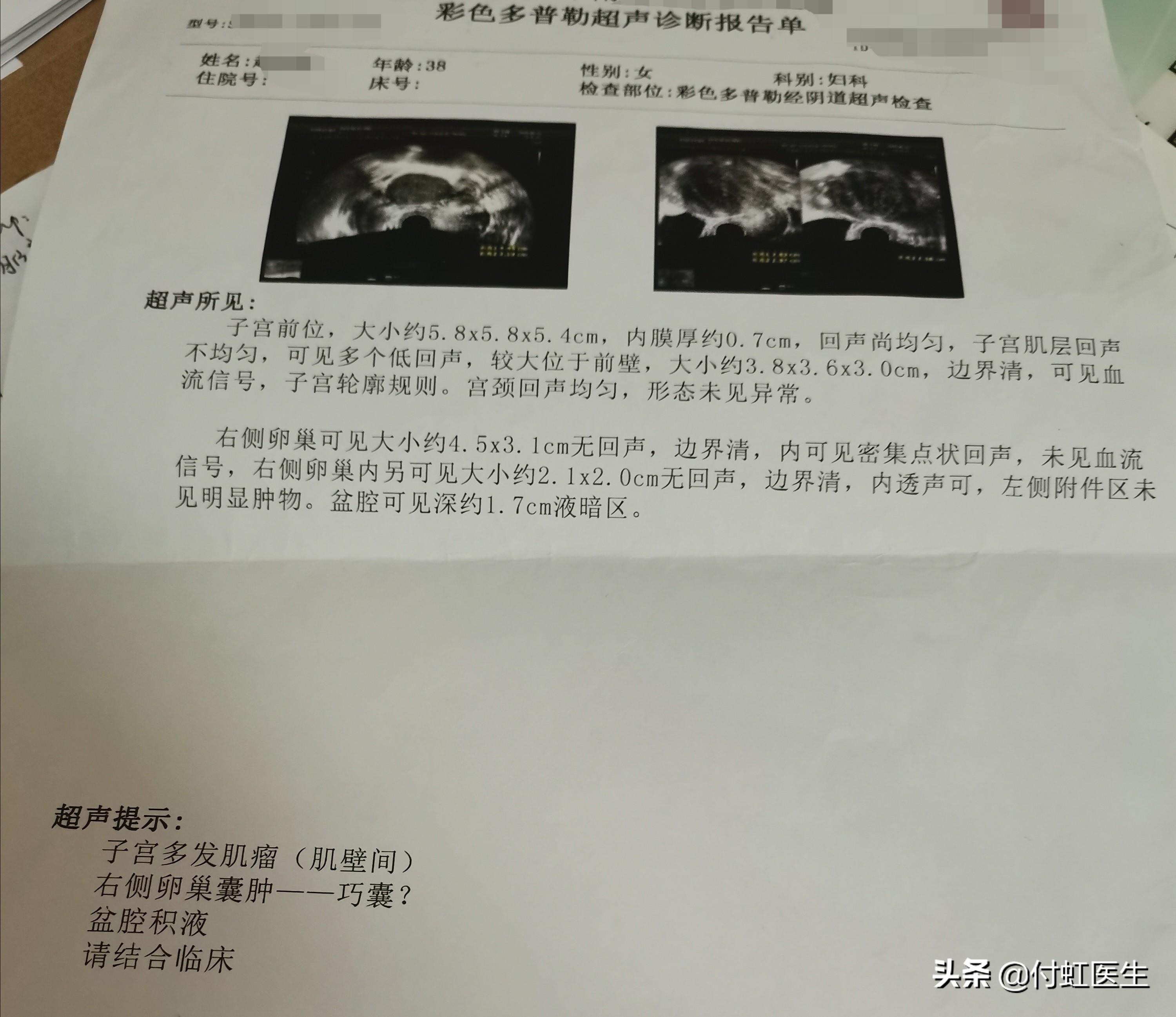 38岁月经量少已经两年了,38岁月经量少