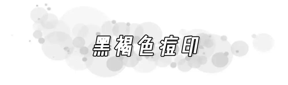 痘印反复冒痘怎么消除男生,痘印痘痘反反复复怎么办