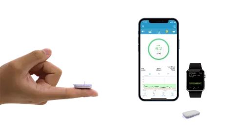 高壁垒高集中，资本和龙头纷纷布局的CGM赛道|行研