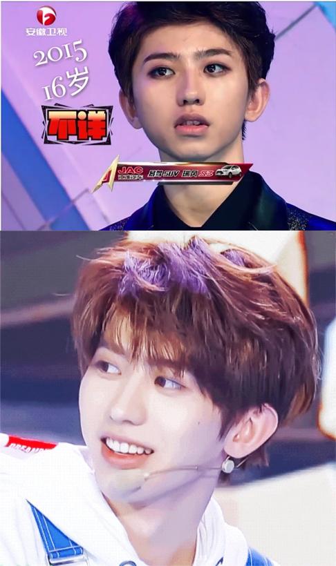 蔡徐坤整牙前图片,蔡徐坤整牙前后照片