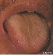 最实用的舌诊图六大舌象,舌诊深入学习书