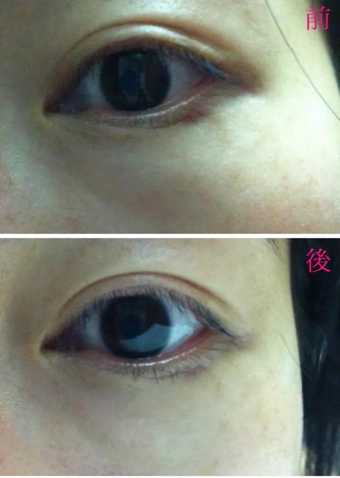 口碑超好眼霜测评,权威测评眼霜机构