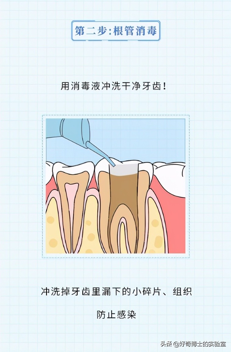 治牙到底有多恐怖,治牙有多痛苦