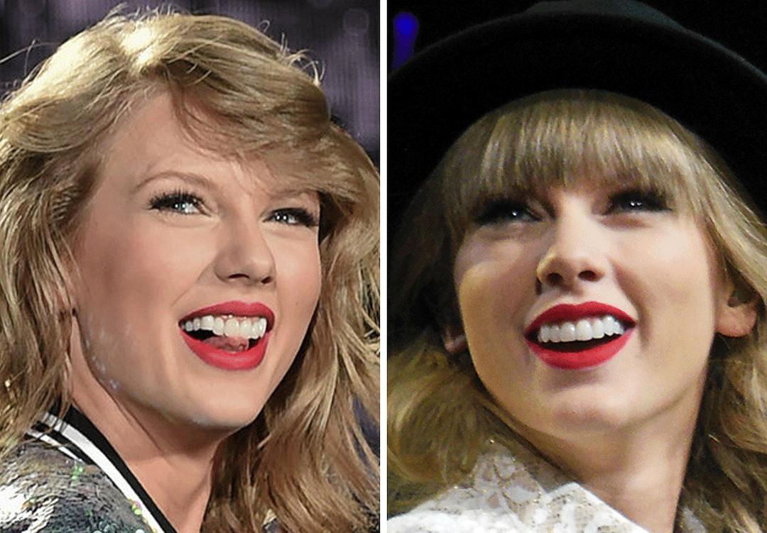 吴宣仪做牙齿前后对比,吴宣仪做整牙