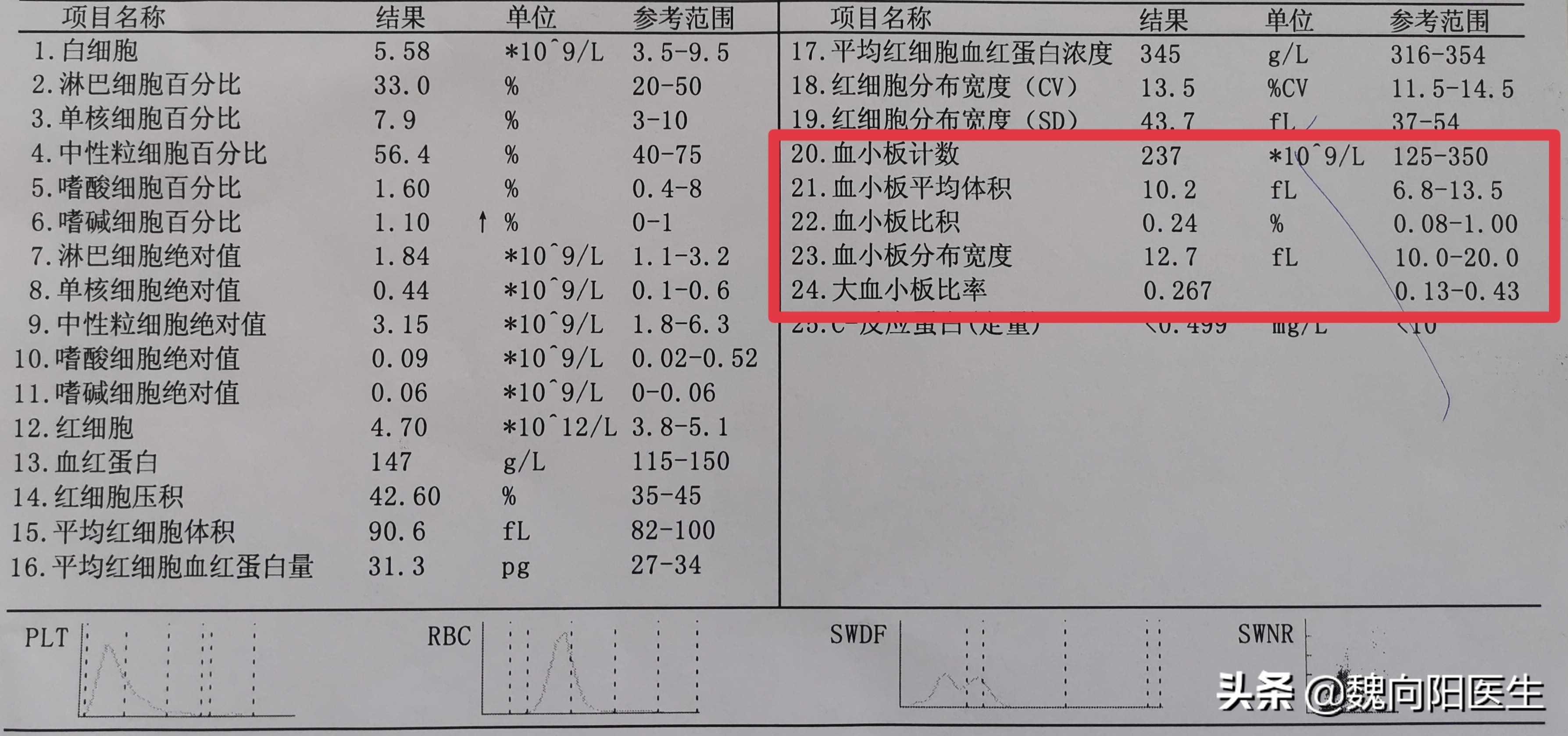 血常规检查中的血小板常识有哪些,血常规护考口诀